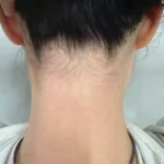 Biowell Bconazine Cream