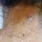 Biowell Bconazine Cream