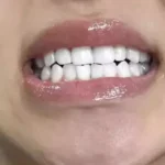 Denticlear Dr.Smile Whitening Pen