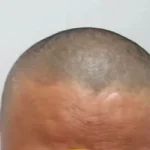 Biowell Bconazine Cream