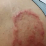 Biowell Bconazine Cream