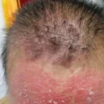 Biowell Bconazine Cream