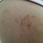 Biowell Bconazine Cream