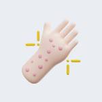 Skin Diseases